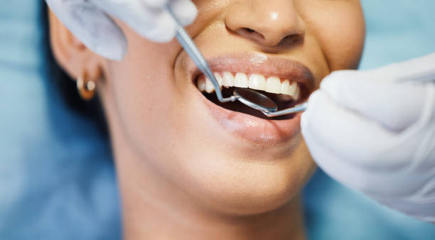 Best Walk-In Emergency Dentist in Oak Ridge, FL