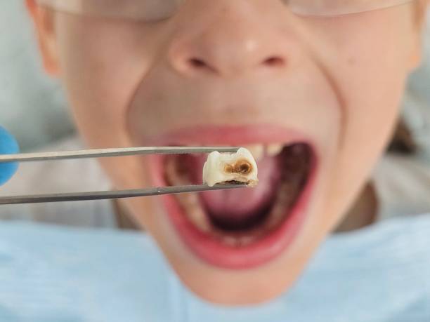 Best Same-Day Emergency Dentist in Oak Ridge, FL